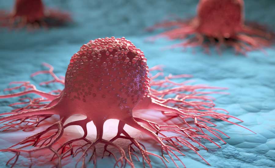 Cancer-cells