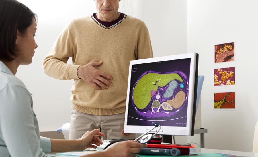 Abdominal scanner of a patient with liver disease and microbiome in the background